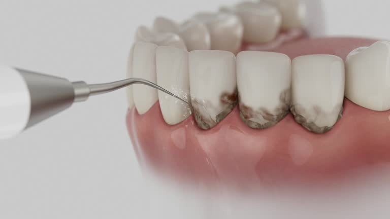 Reliable Dental contractor in Walnut Creek, OH by Dentist Open Now
